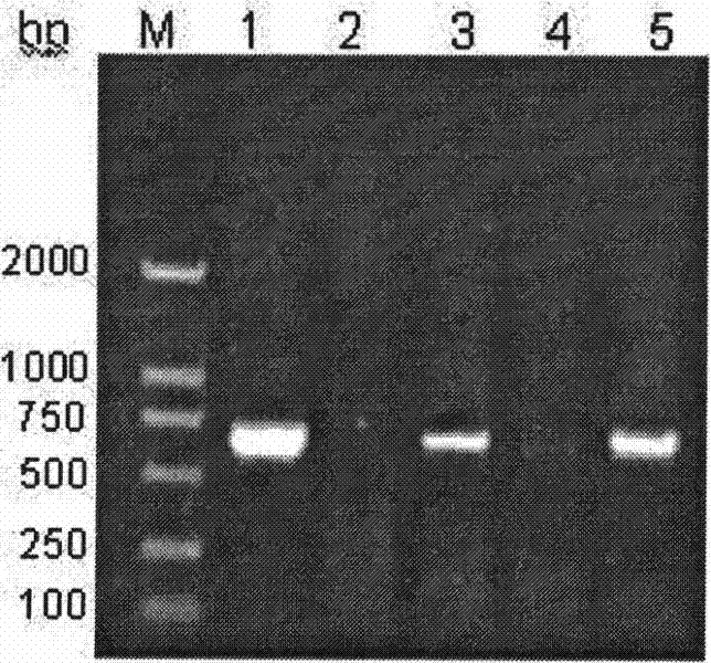 A method and kit for detecting hepatitis B virus genotype