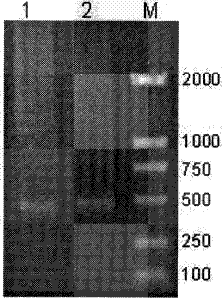 A method and kit for detecting hepatitis B virus genotype