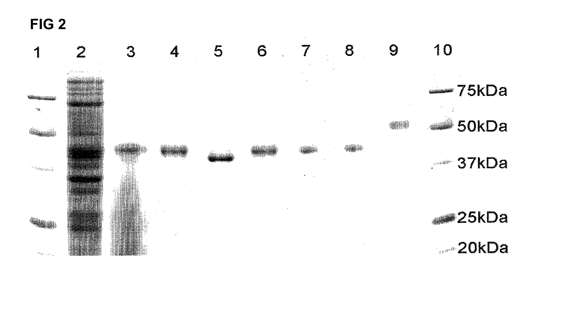 Thermostable alpha1-antitrypsin mutein with a disulfide bond and the method for preparing it