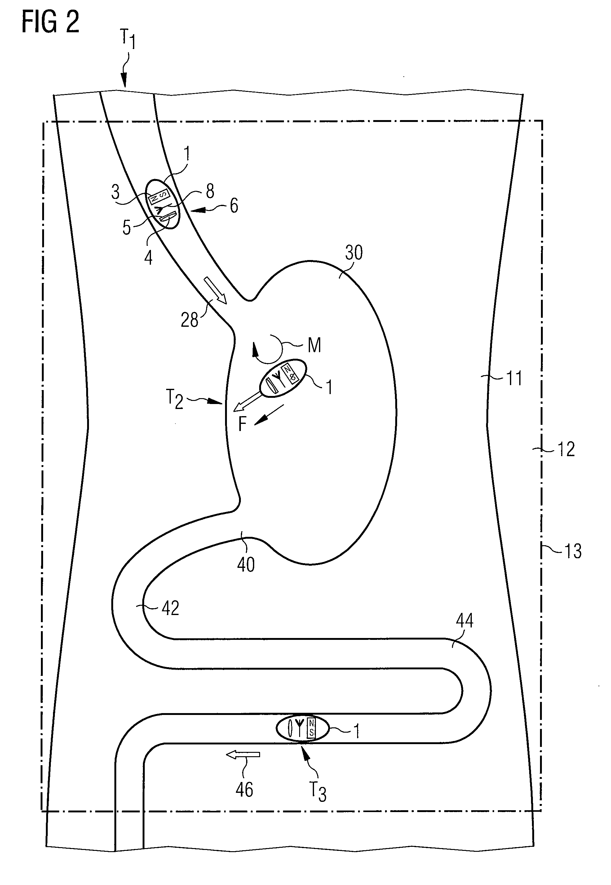 Endoscopic Capsule