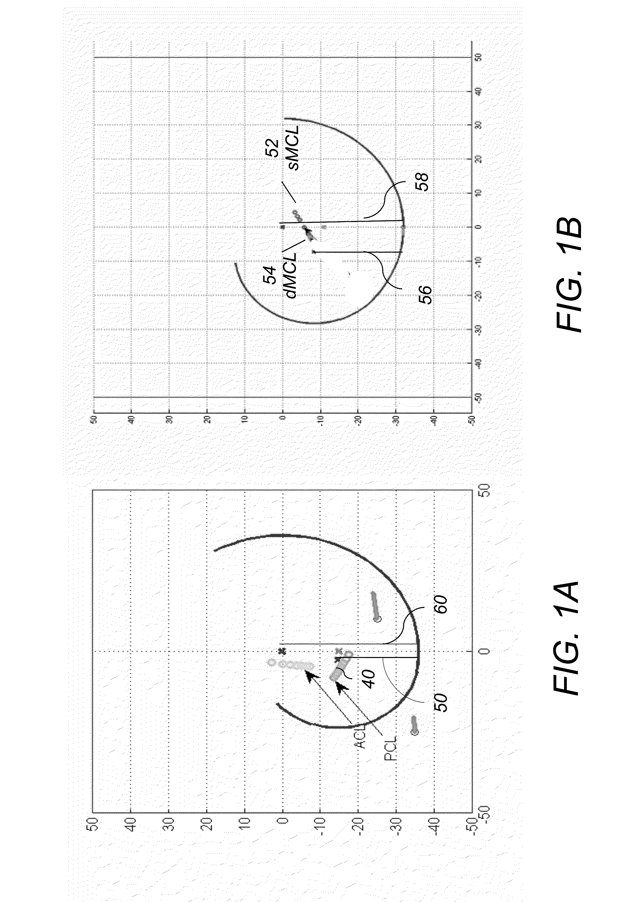 System and method for ligament insertion in knee joint surgeries using adaptive migration of ligament insertion geometry