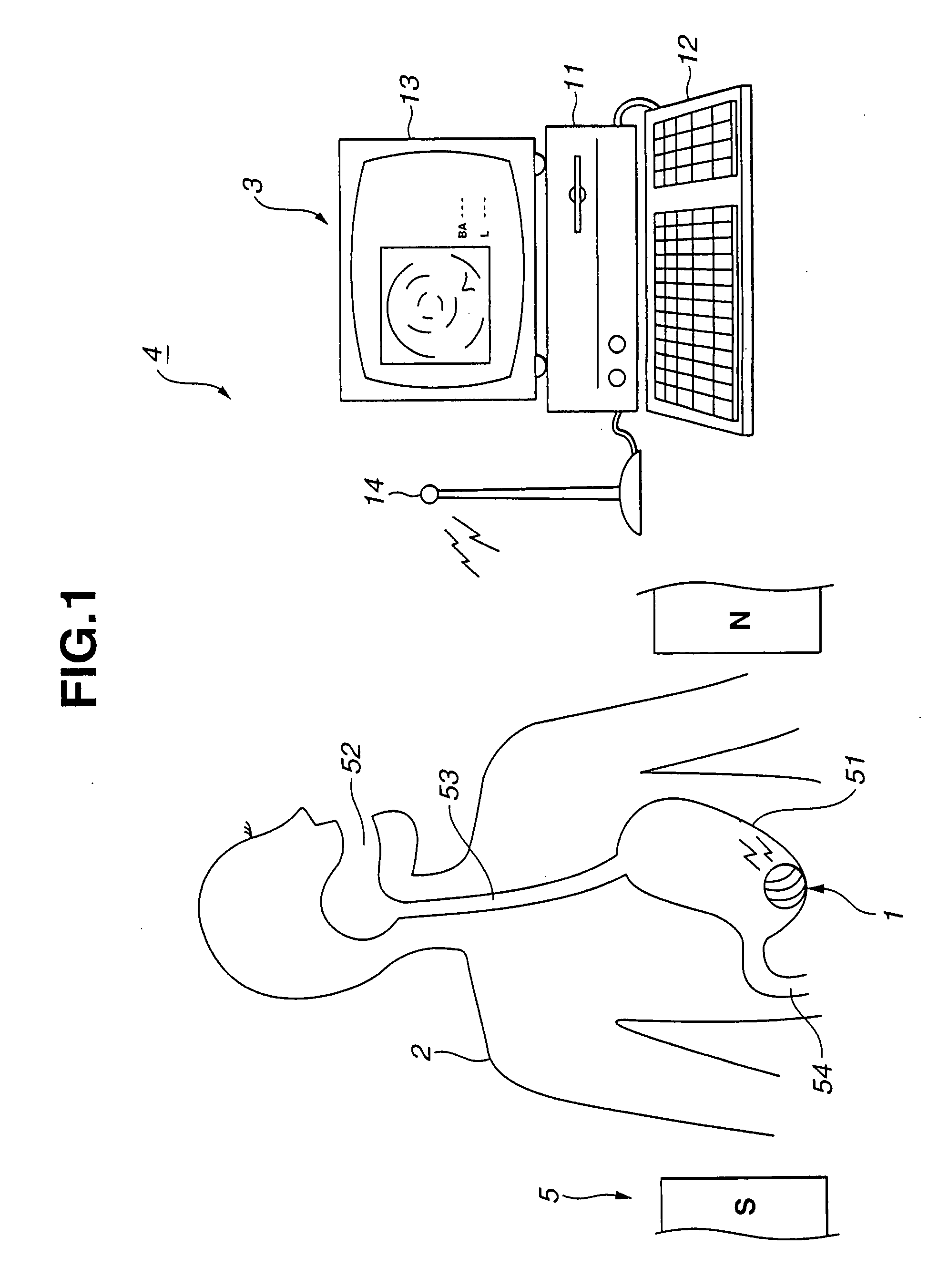 Capsule-type medical device