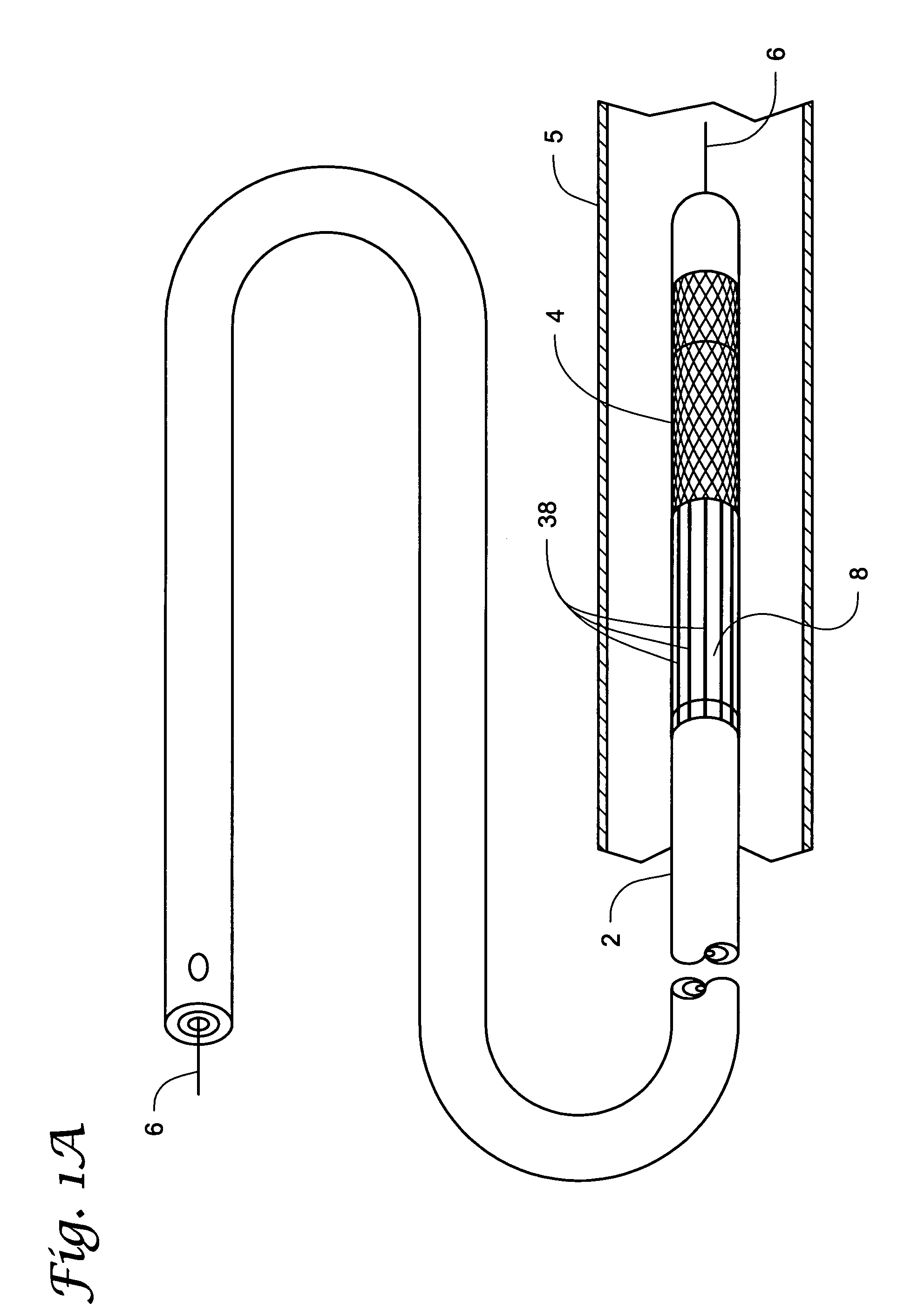 Medical device and method of intravenous filtration