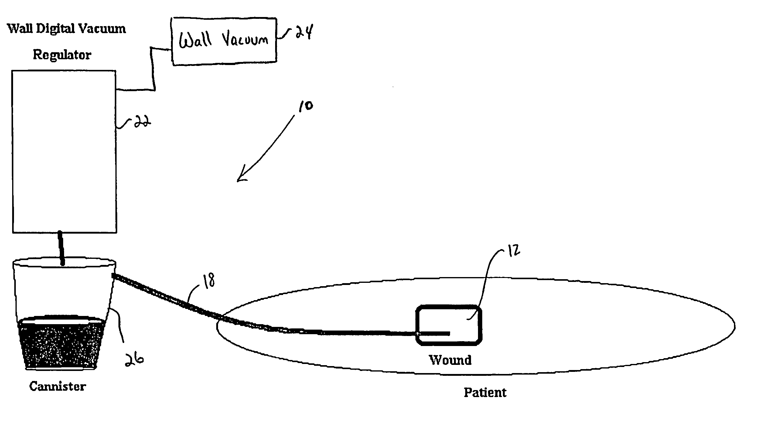 Wound care apparatus