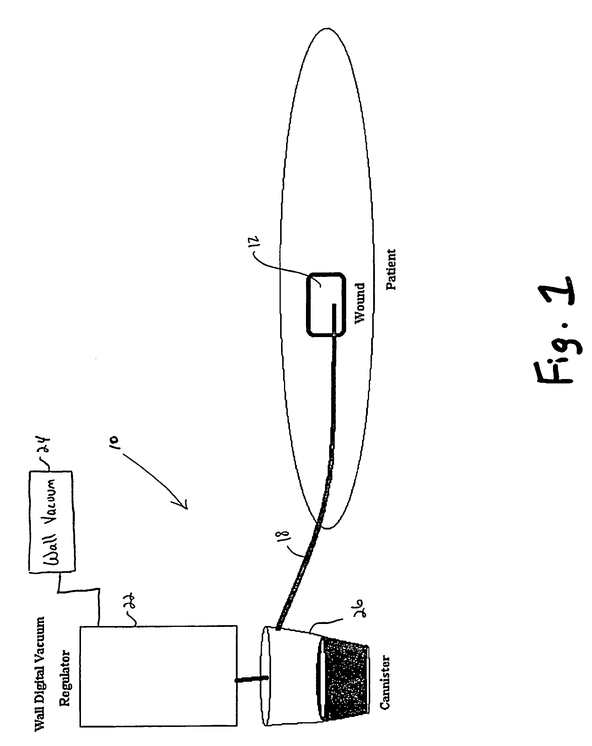 Wound care apparatus