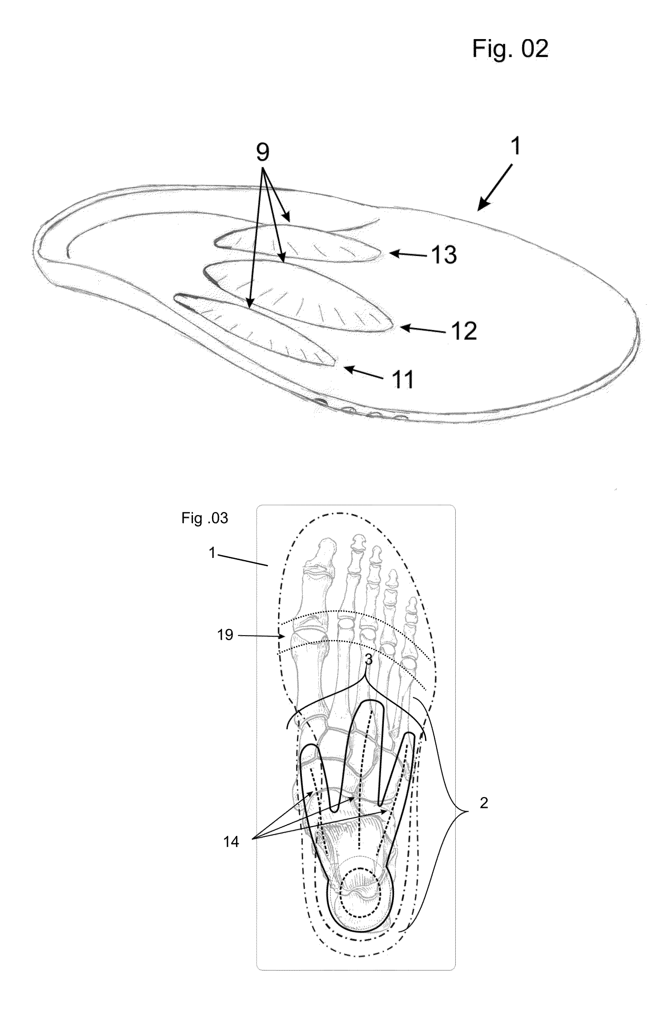 Shoe Insole or Midsole with a Tri-Dome Configuration for Foot Rehabilitation