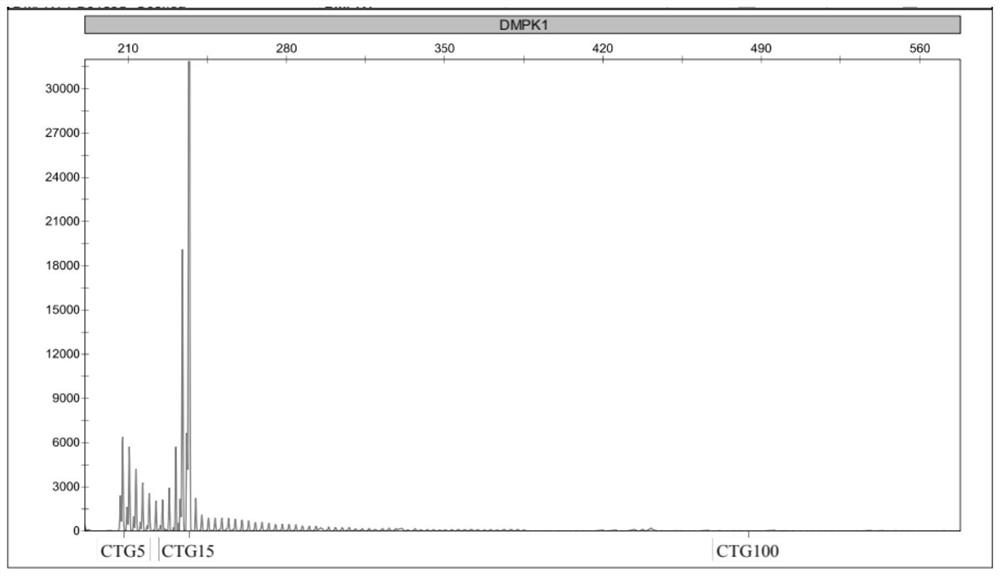 PCR (polymerase chain reaction) detection kit for CTG (cytotoxic T G) region of atrophic myotonin kinase gene and application of PCR detection kit