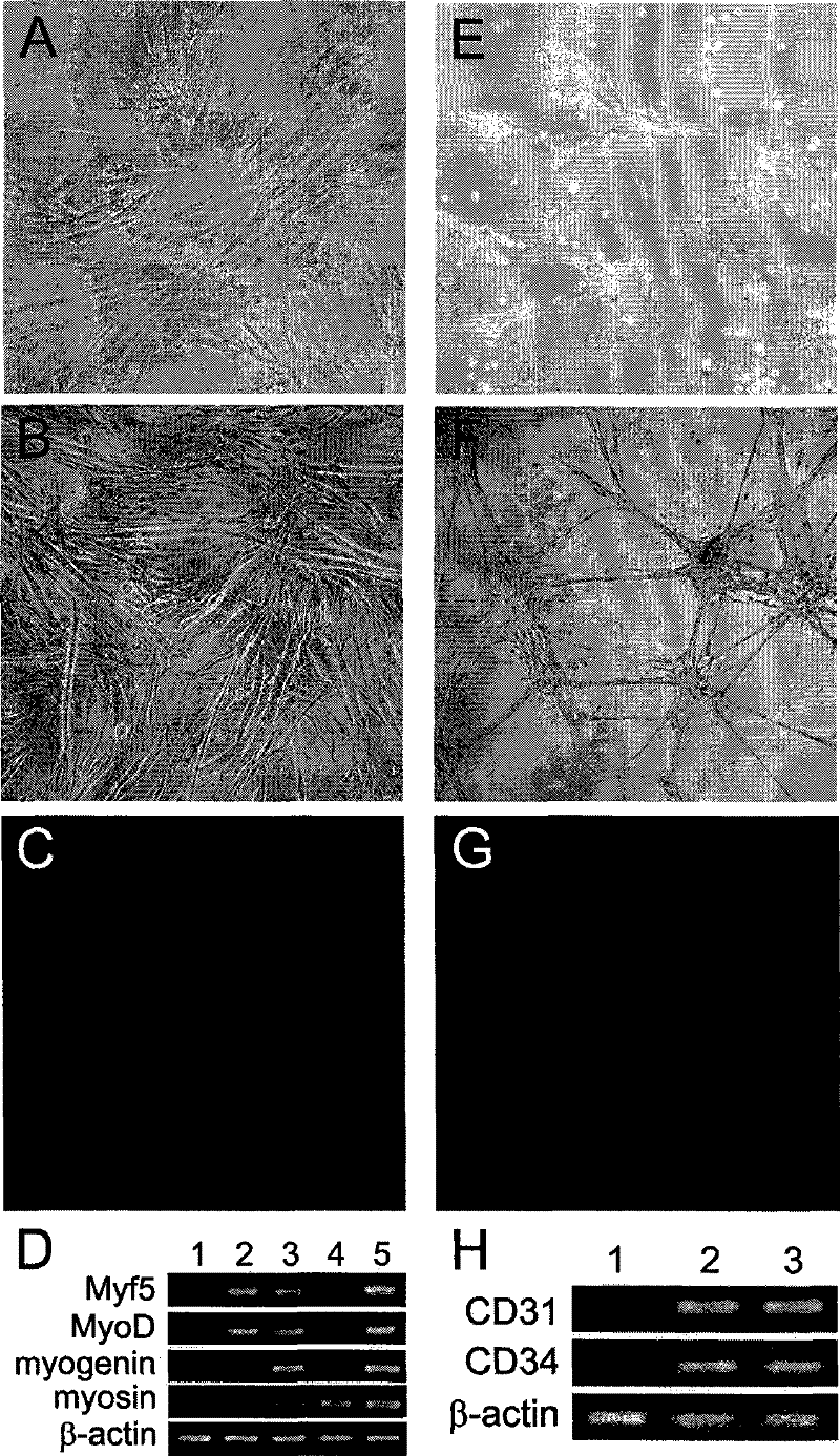 Method for isolated culture of human fat mesenchyma stem cell and special culture medium thereof