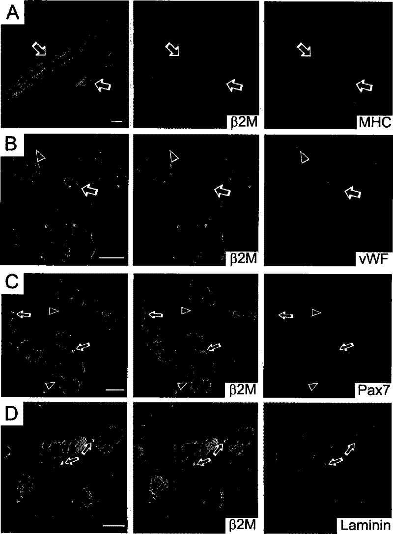 Method for isolated culture of human fat mesenchyma stem cell and special culture medium thereof