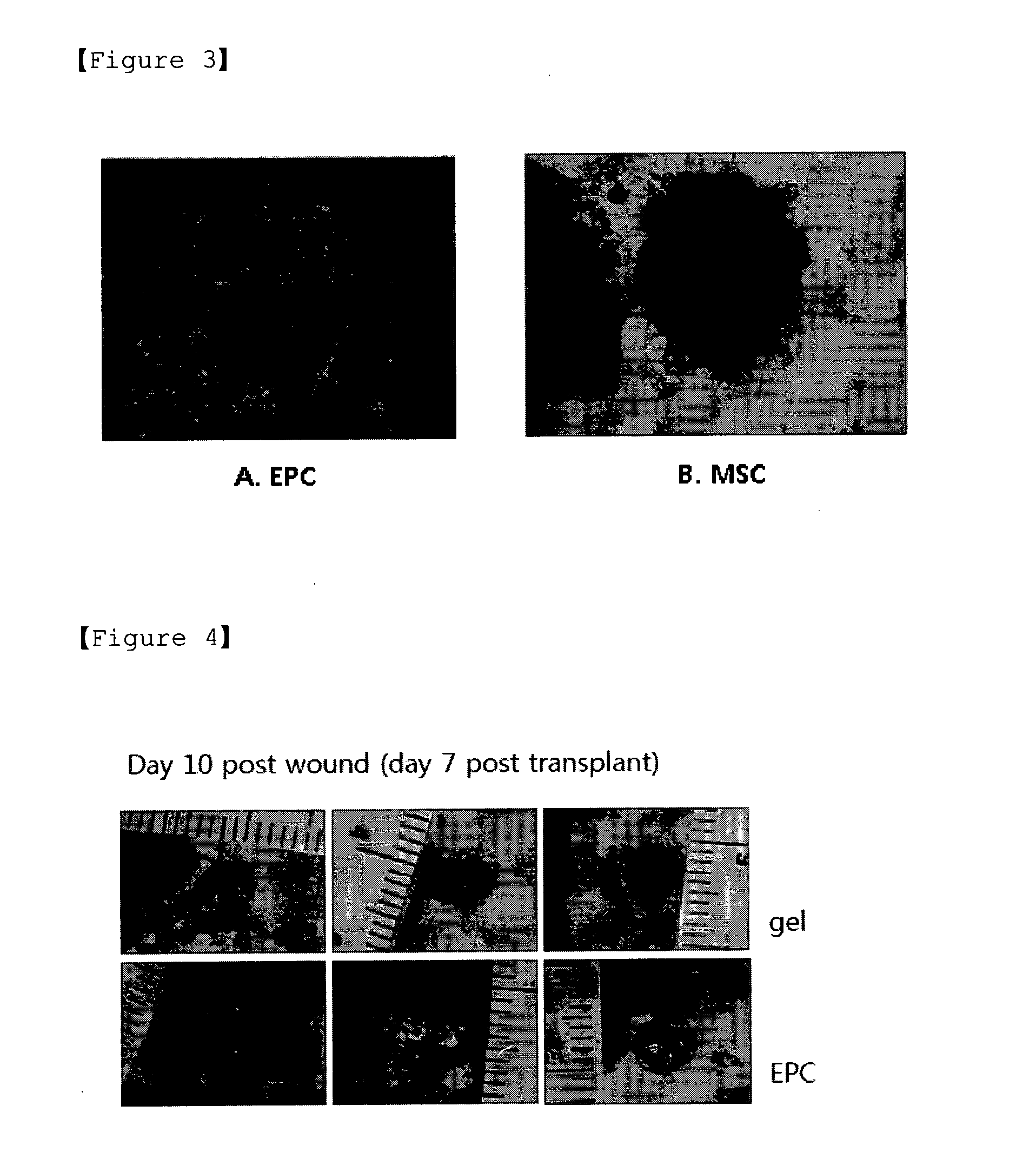 Agent for stimulating mobilization of endothelial progenitor cells