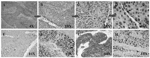 Isolation and culture method of primary cervical cancer cells