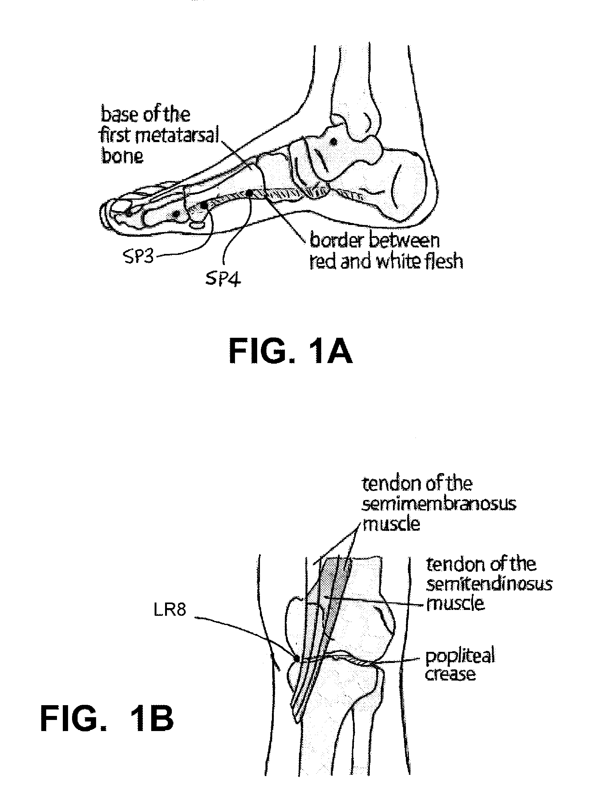 Implantable Electroacupuncture System and Method for Treating Dyslipidemia and Obesity