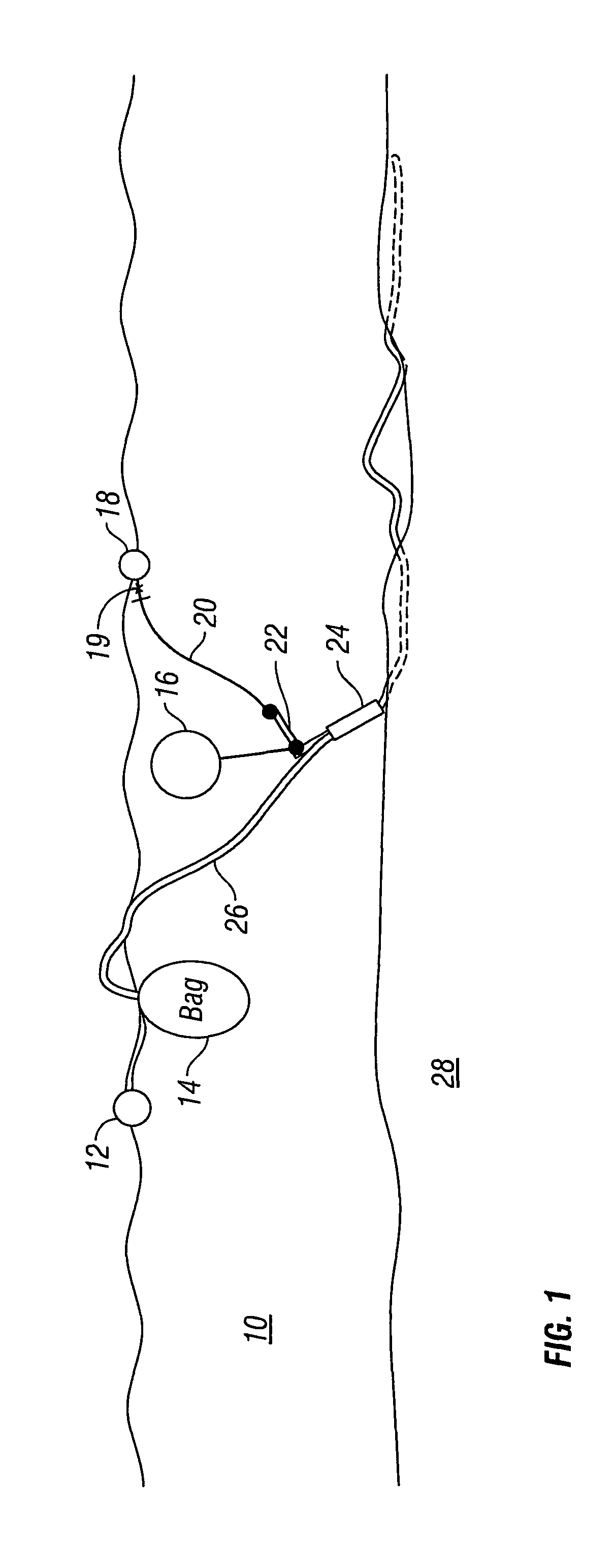 Passive marine equipment recovery device