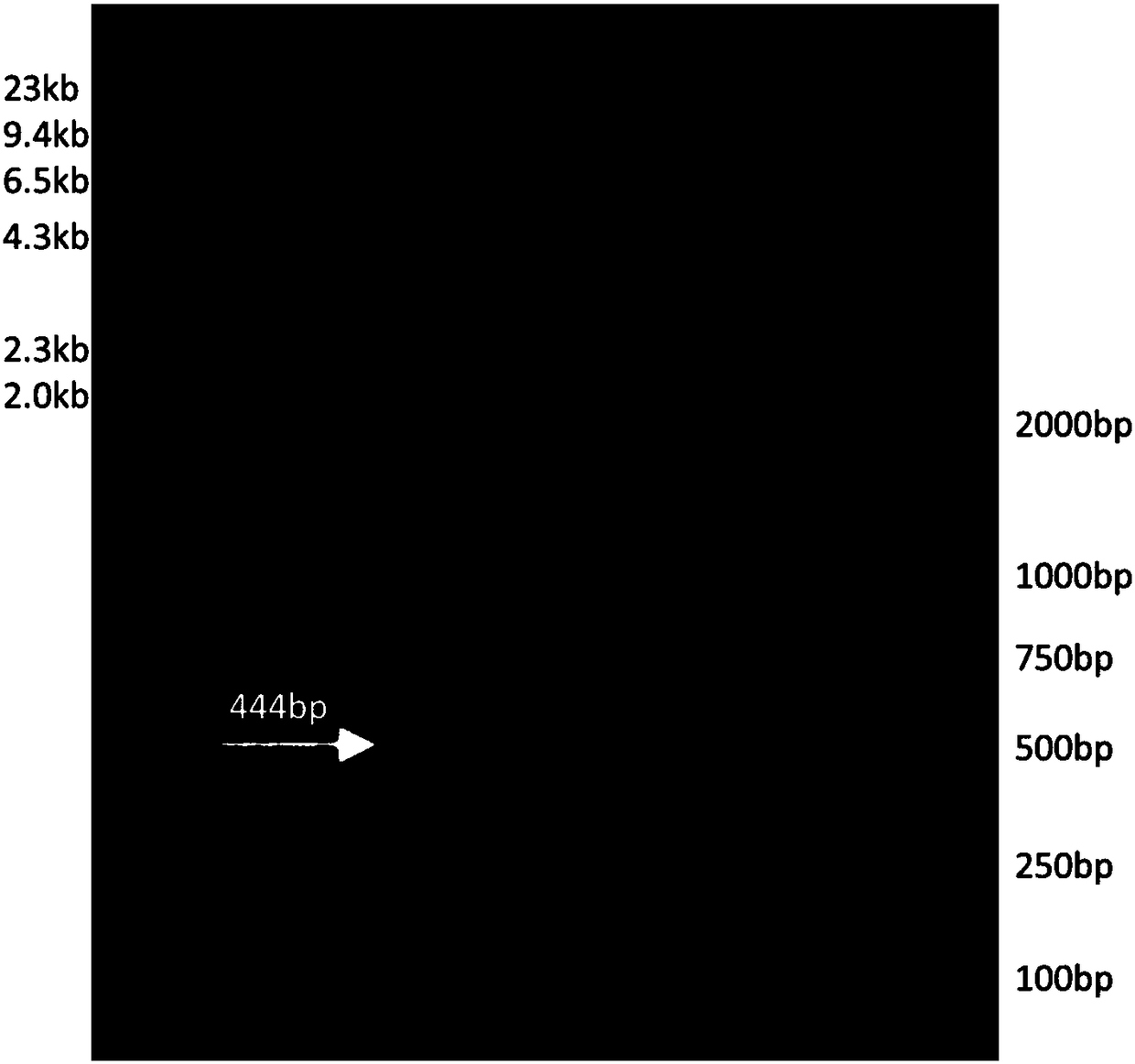 Preparation method of recombinant anti-TNF-alpha completely humanized monoclonal antibody