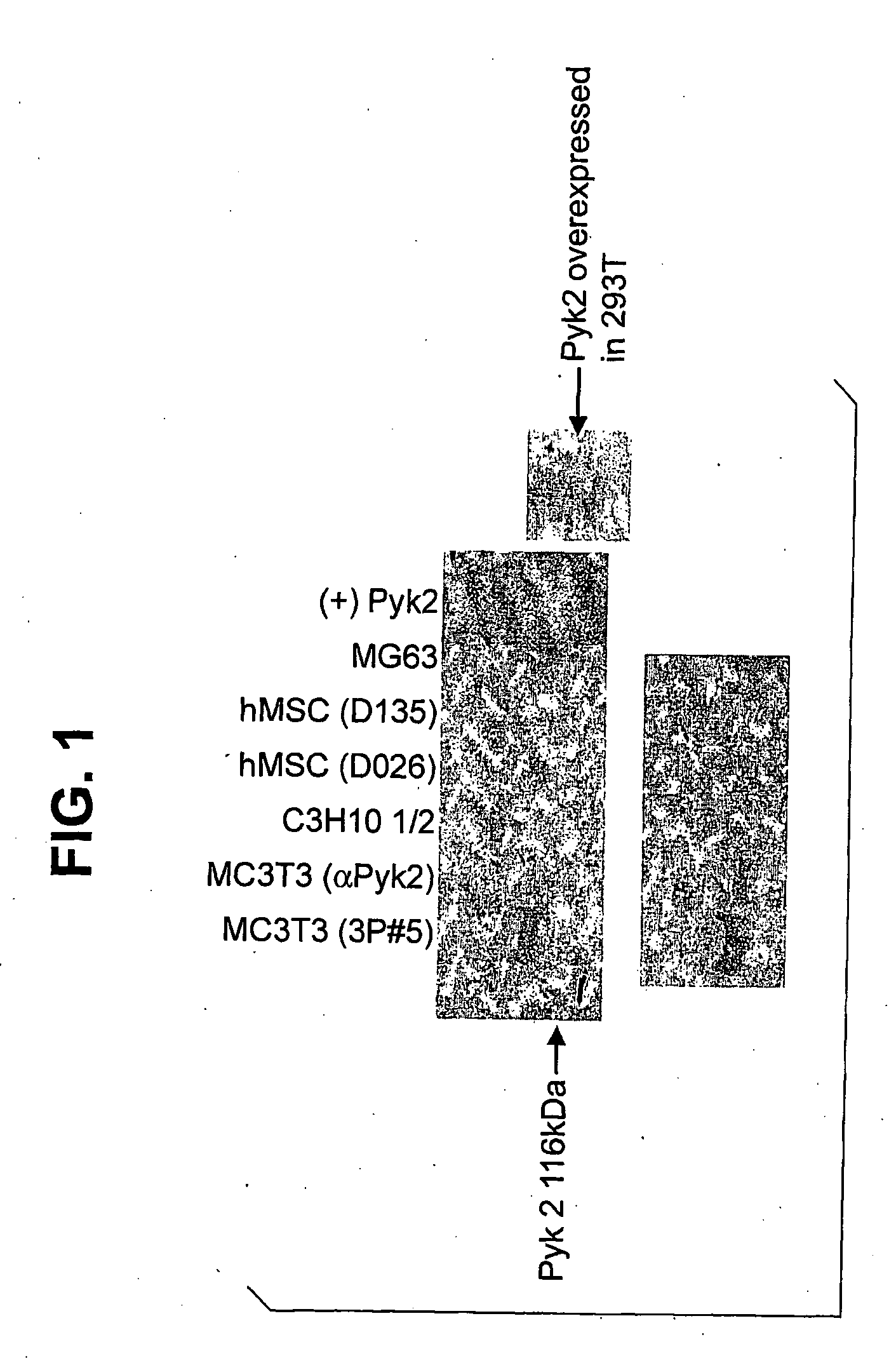 Methods for Augmenting Bone