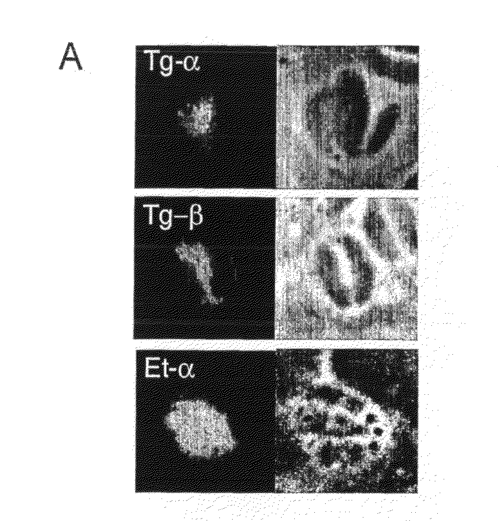 Coccidian Parasite Casein Kinase I as a Chemotherapeutic Target for Antiprotozoal Agents