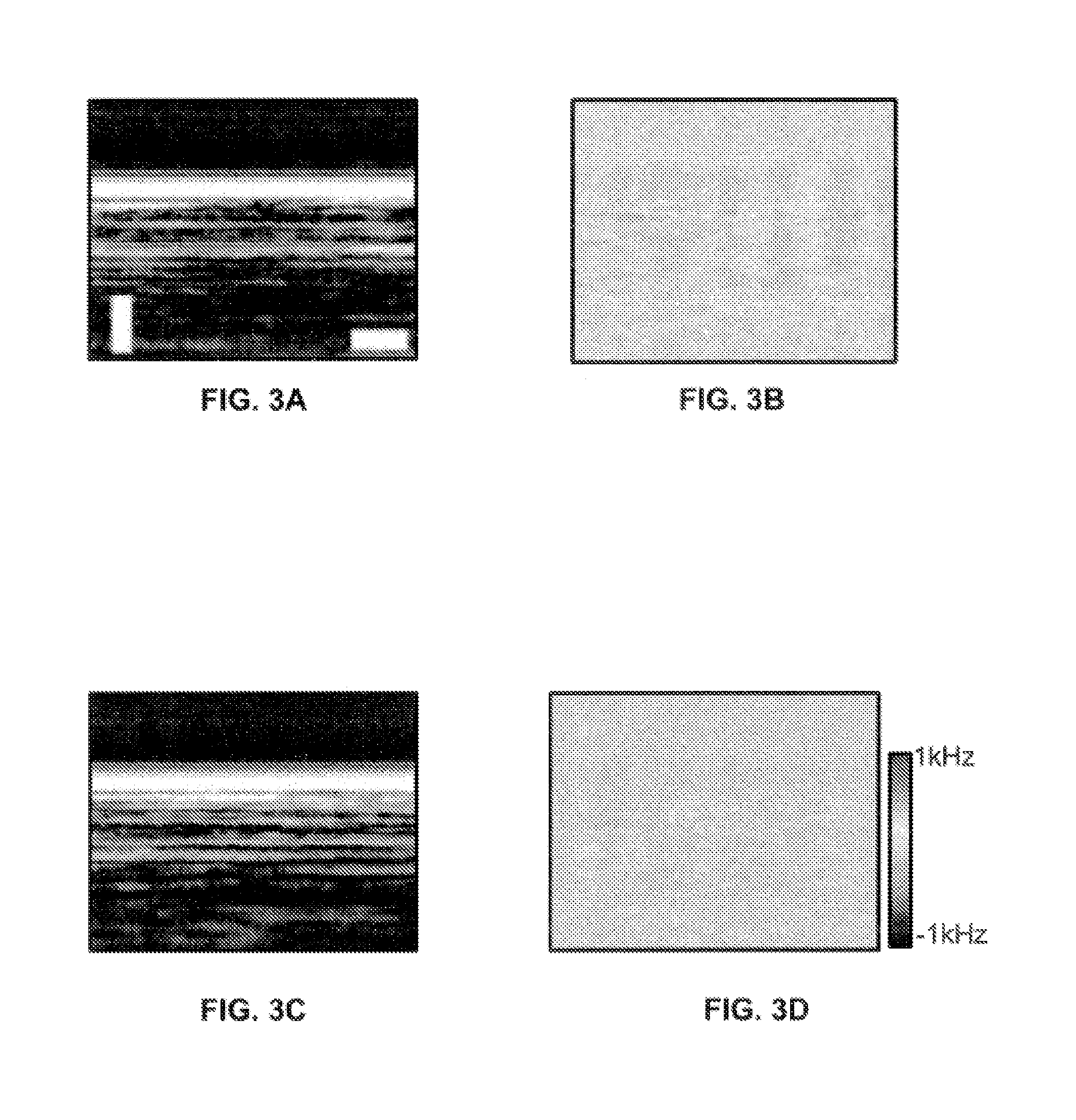 Hemoglobin contrast in magneto-motive optical doppler tomography, optical coherence tomography, and ultrasound imaging methods and apparatus