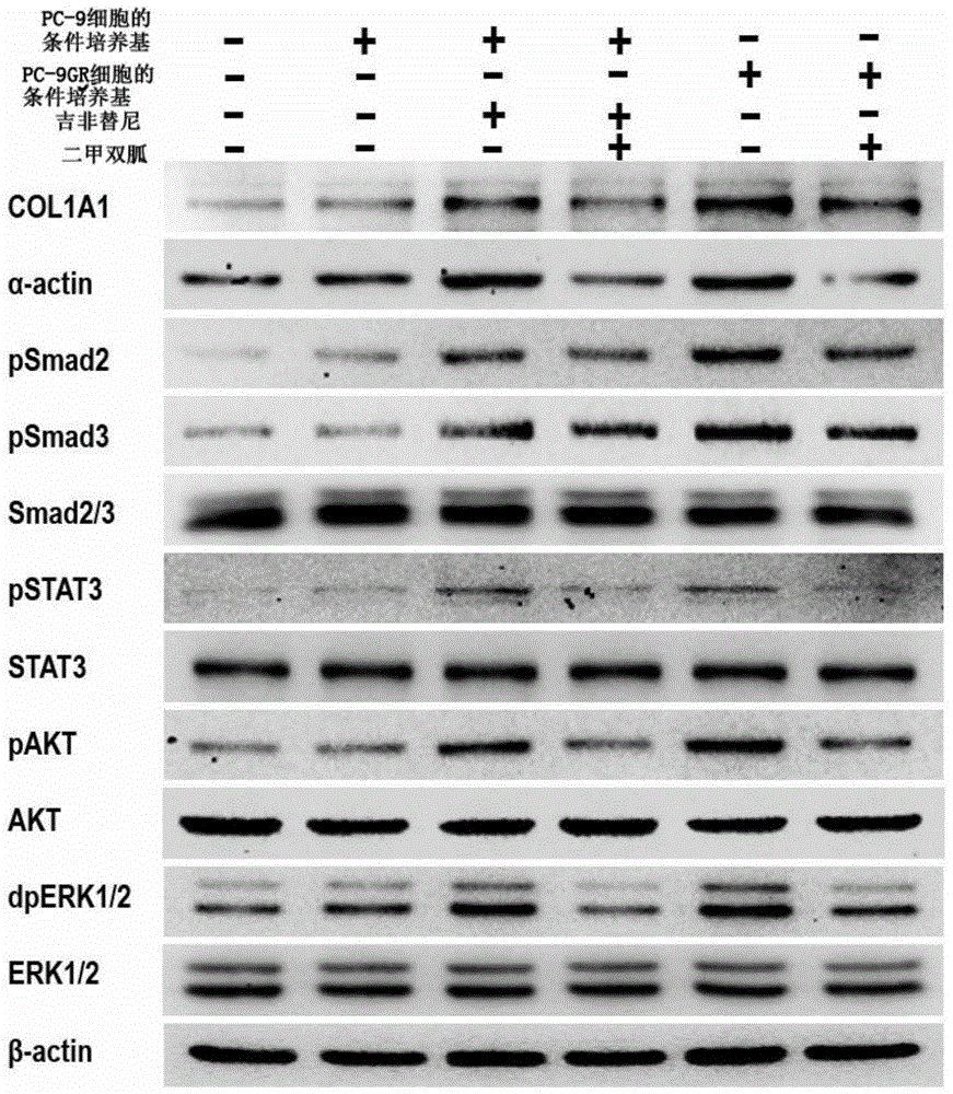 Complex for preventing or weakening pulmonary fibrosis, preparation prepared from complex and application of complex