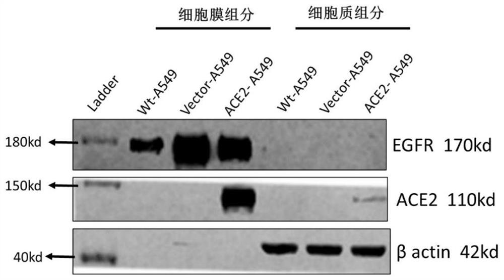 Method for preventing and treating respiratory infectious diseases by using respiratory epithelial cell membranes and application