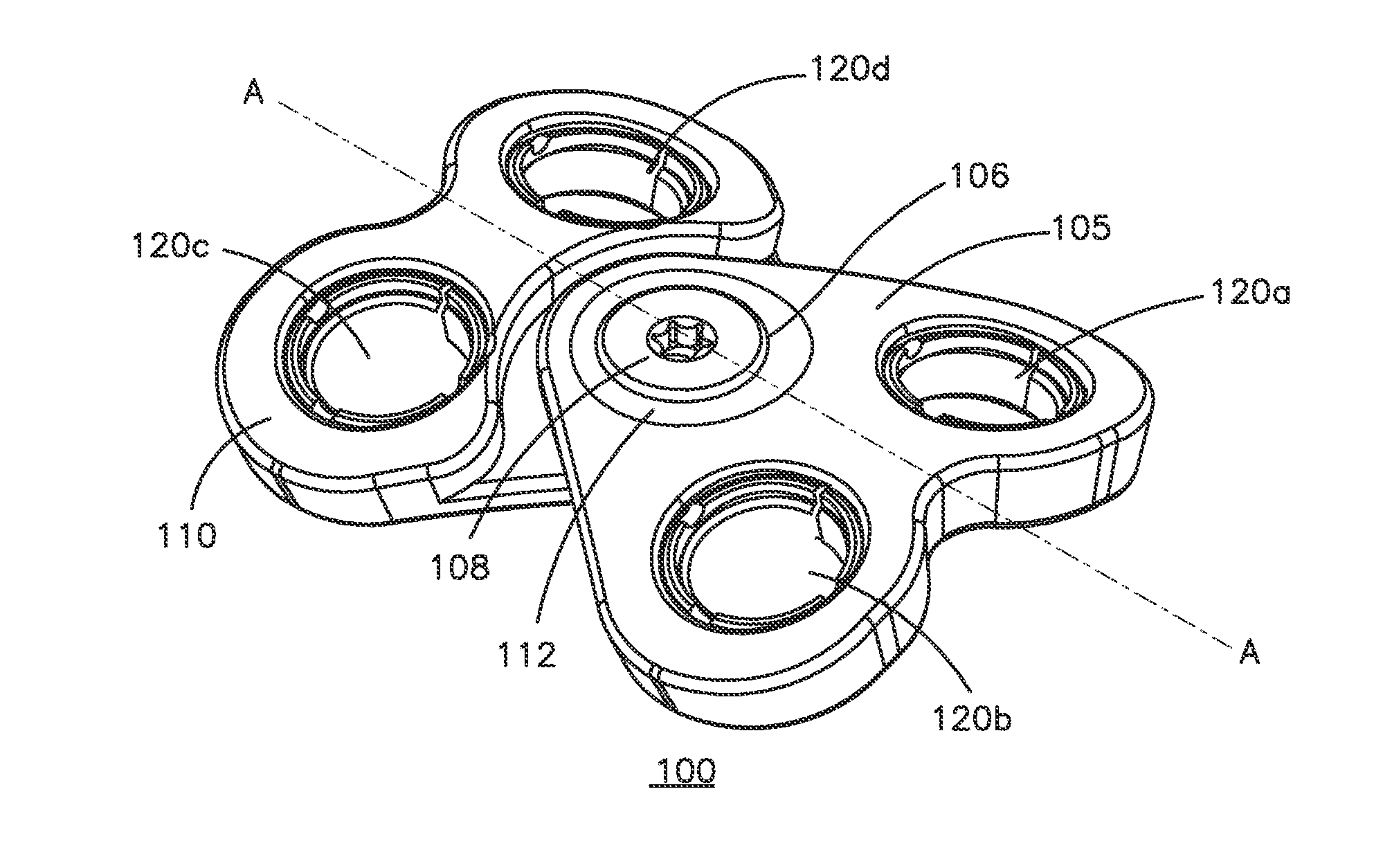 Anterior transpedicular screw-and-plate system