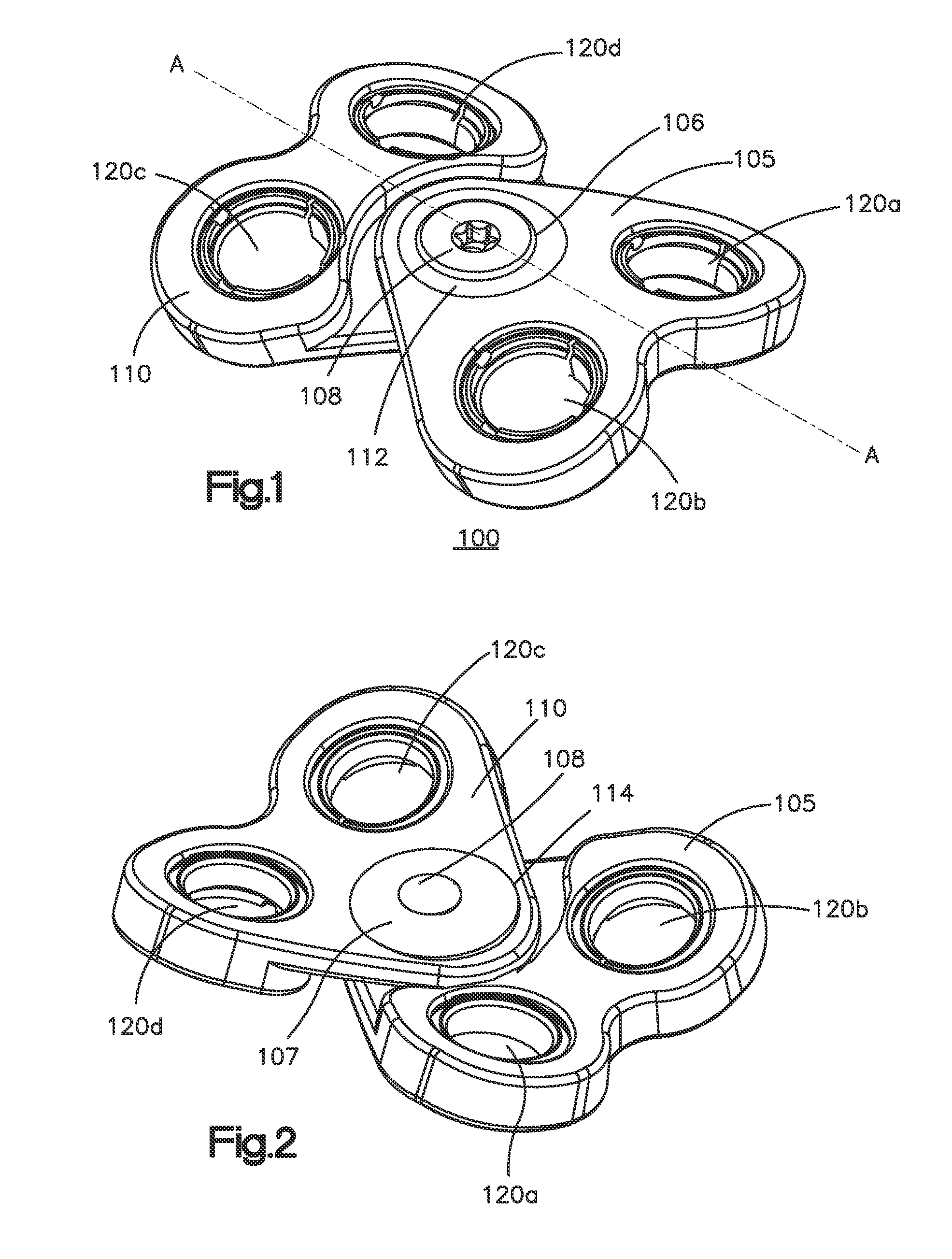 Anterior transpedicular screw-and-plate system