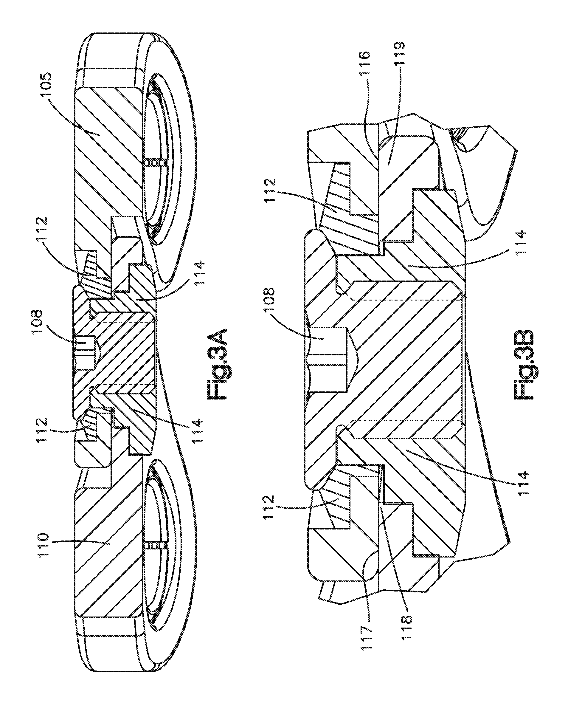 Anterior transpedicular screw-and-plate system