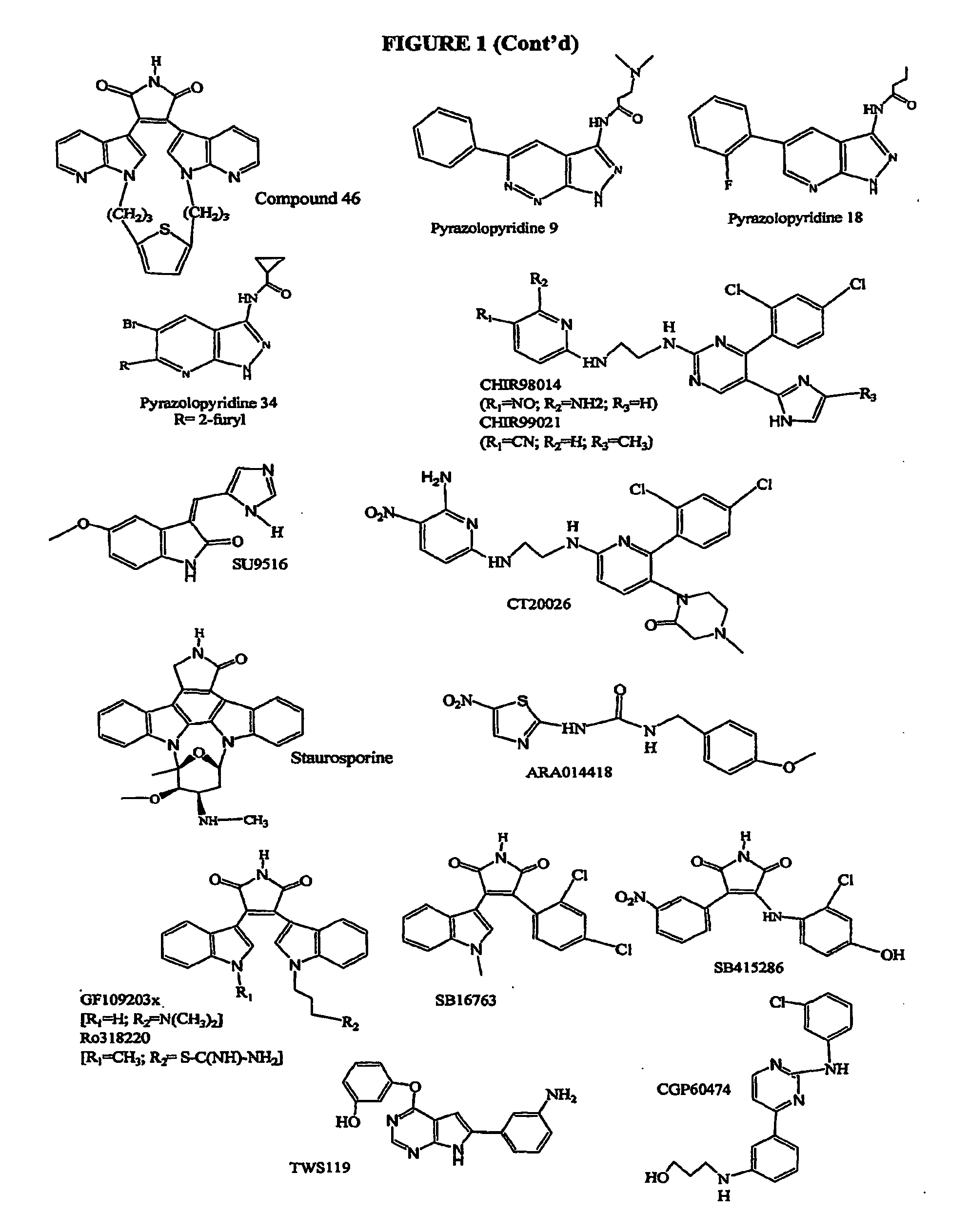 Inhibition of Glycogen Synthase Kinase and Methods of Treating Autoimmune or Immune Inflammatory Disease