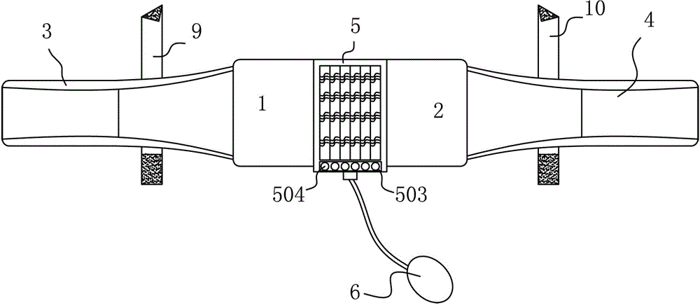 External sternal fixation device