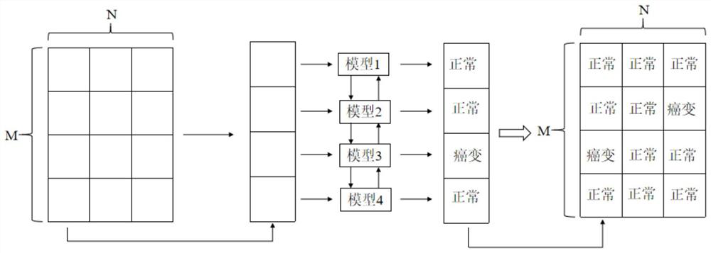 Pathological slice detection method and device, computer equipment and storage medium