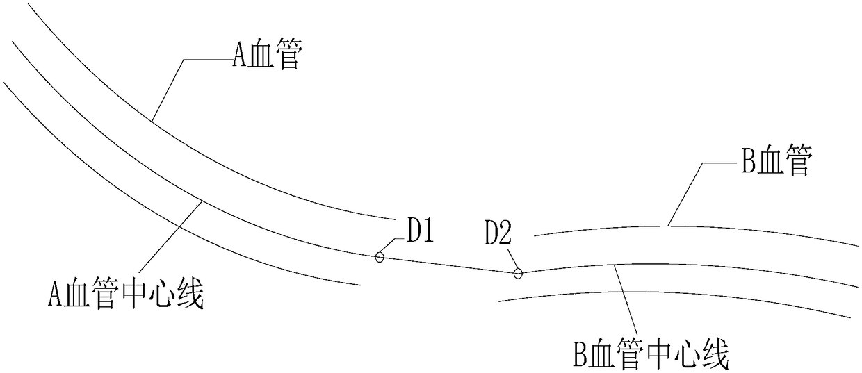 Retinal blood vessel image editing method and retinal blood vessel image editing device