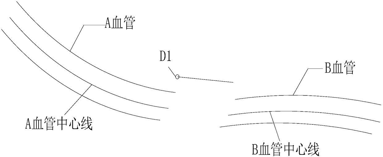 Retinal blood vessel image editing method and retinal blood vessel image editing device