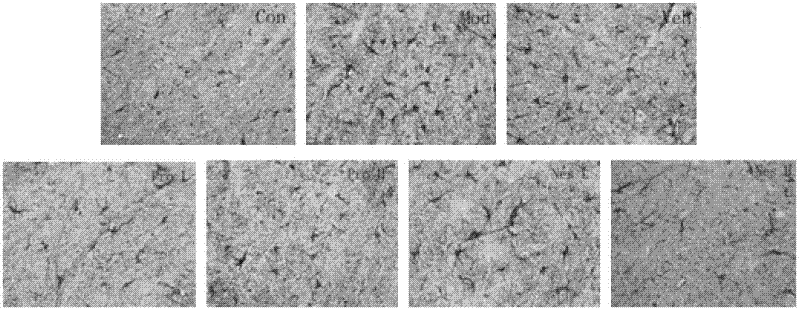 Application of nestorone to preparation of drugs for treating Parkinson's disease