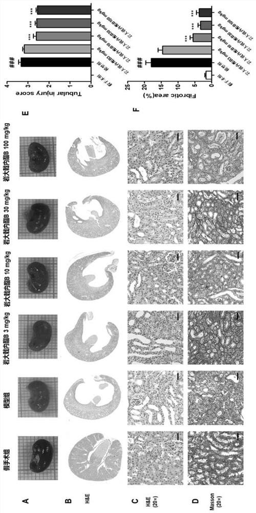 Application of jolkinolide B in preparation of drugs for preventing and treating chronic kidney diseases