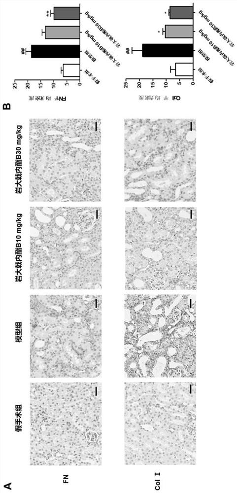 Application of jolkinolide B in preparation of drugs for preventing and treating chronic kidney diseases