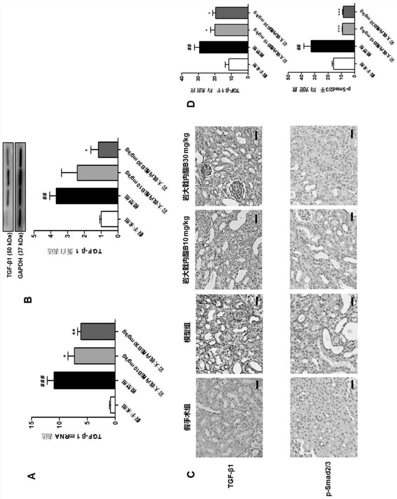 Application of jolkinolide B in preparation of drugs for preventing and treating chronic kidney diseases