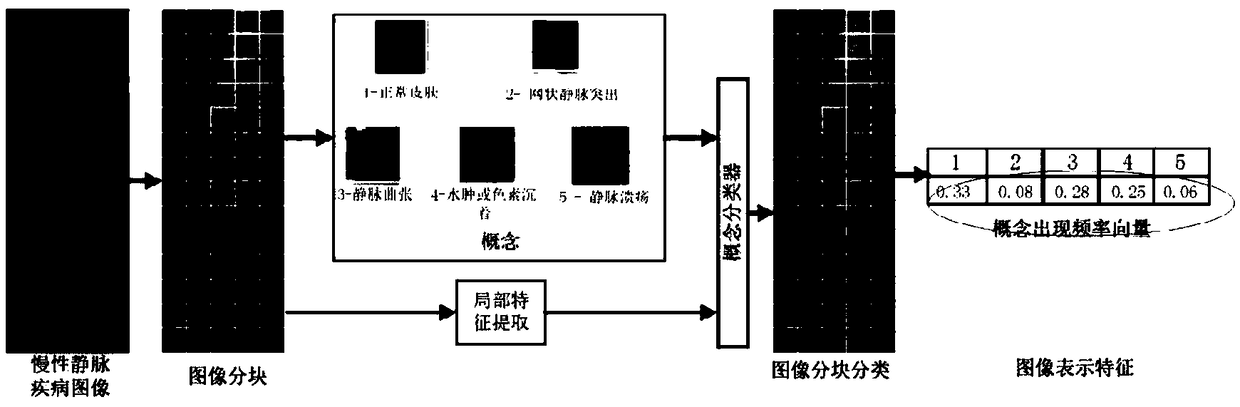 Image classification method for chronic venous disease based on multi-scale semantic features