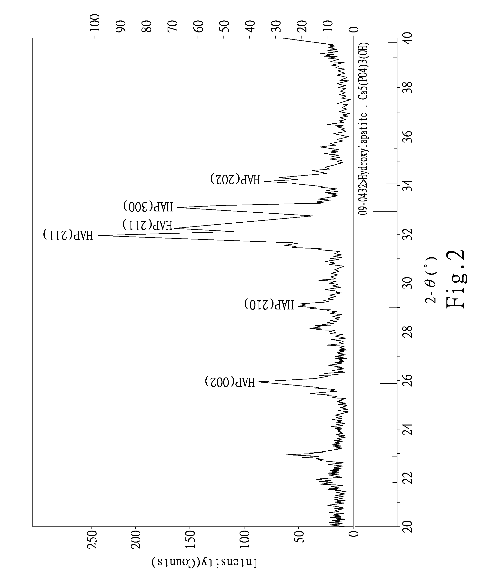 Bio-Degenerable Bone Cement and Manufacturing Method thereof