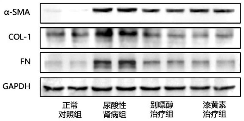 Application of fisetin in preparation of medicine for preventing and treating uric acid nephropathy