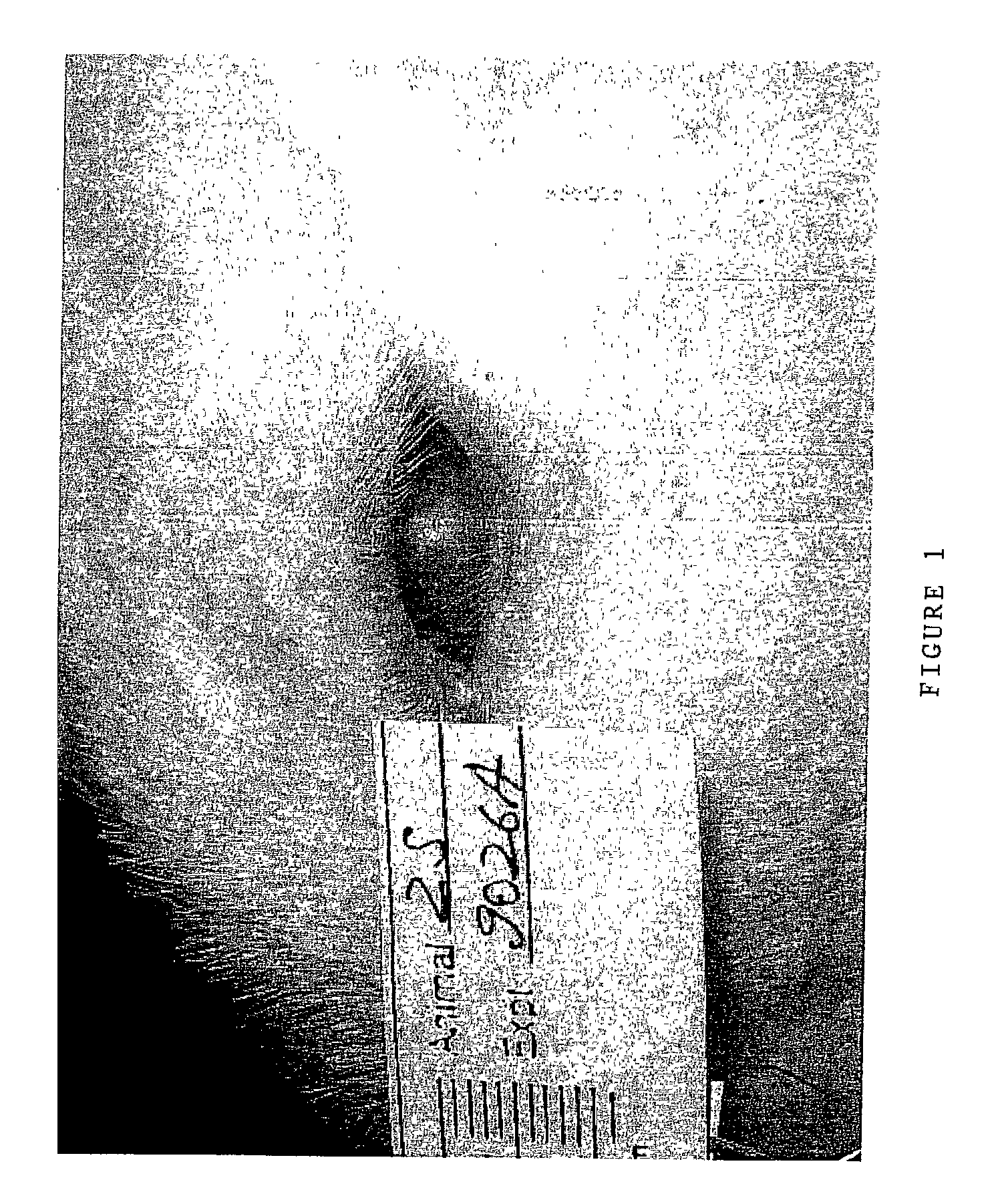 Compositions comprising microspheres with anti-inflammatory properties for healing of ocular tissues