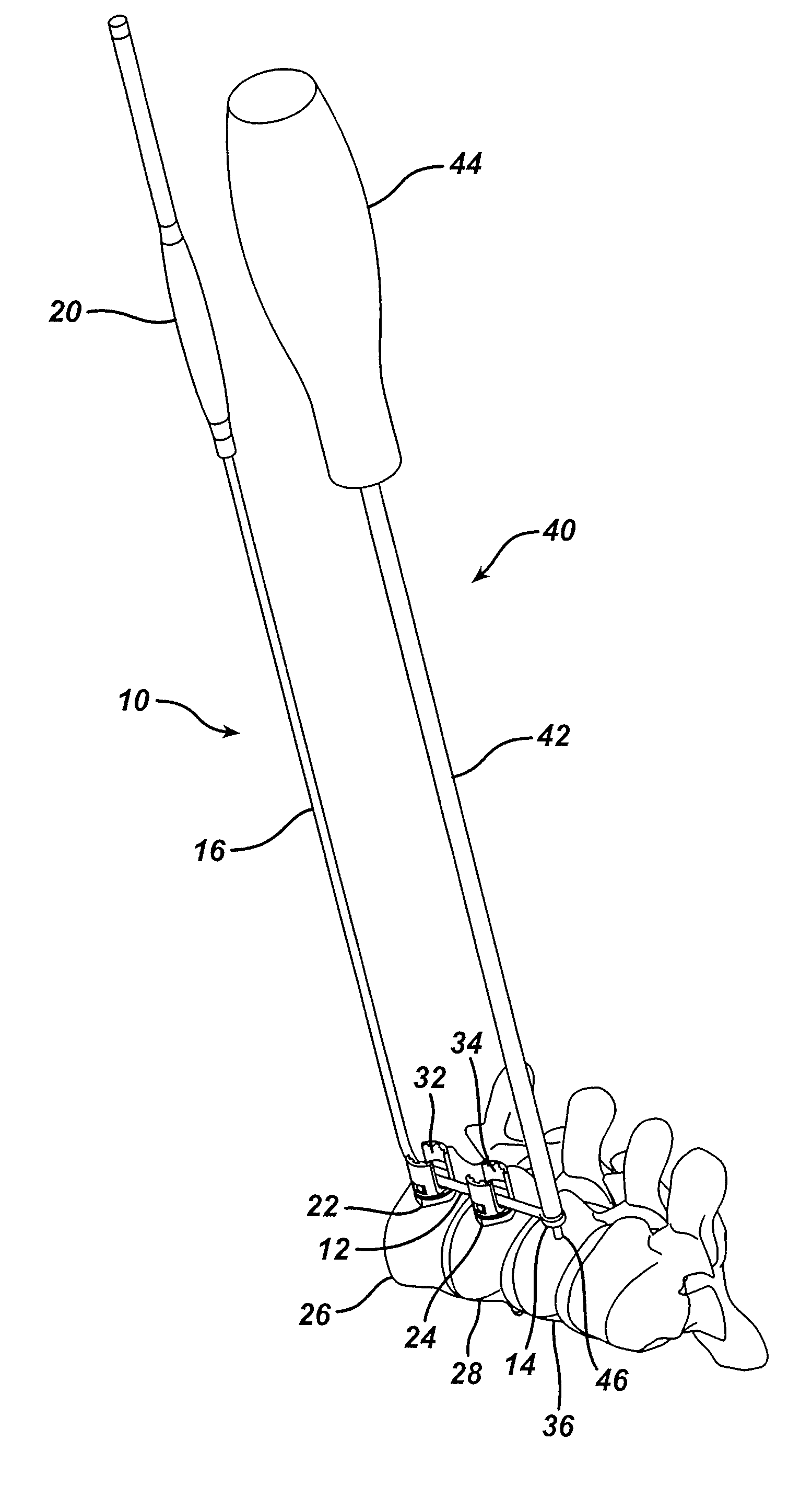 Screw placement guide