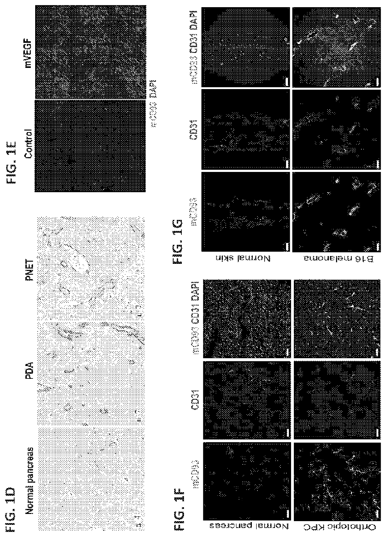 Methods and compositions for treating a disease or disorder