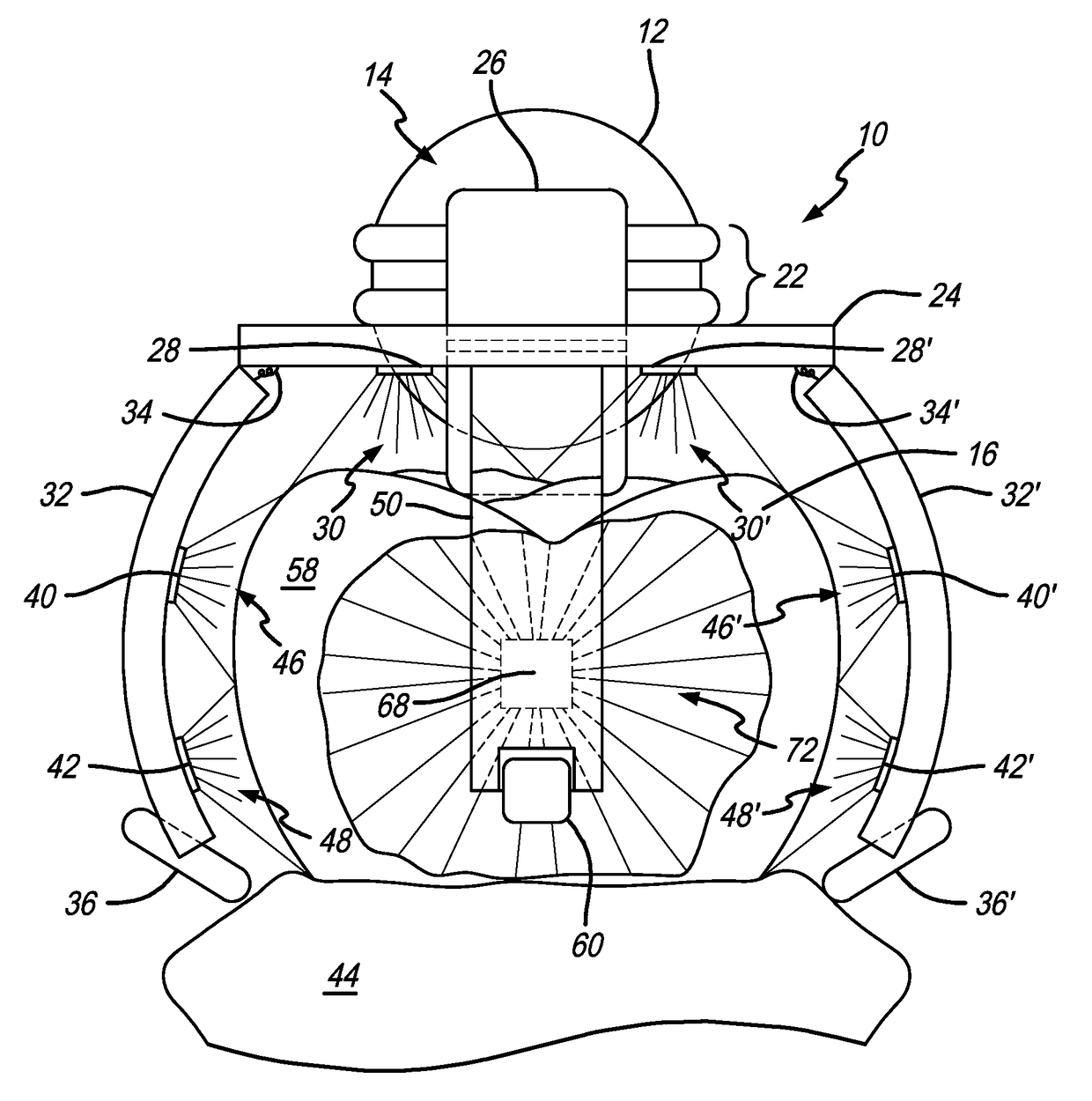 Dental imager and method for recording photographic impressions