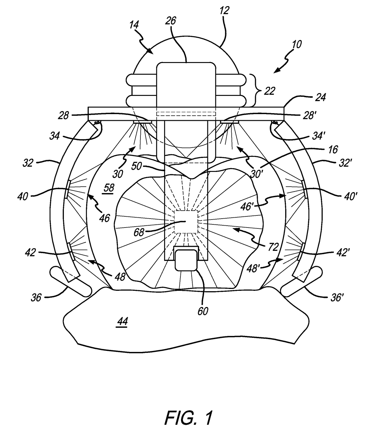 Dental imager and method for recording photographic impressions