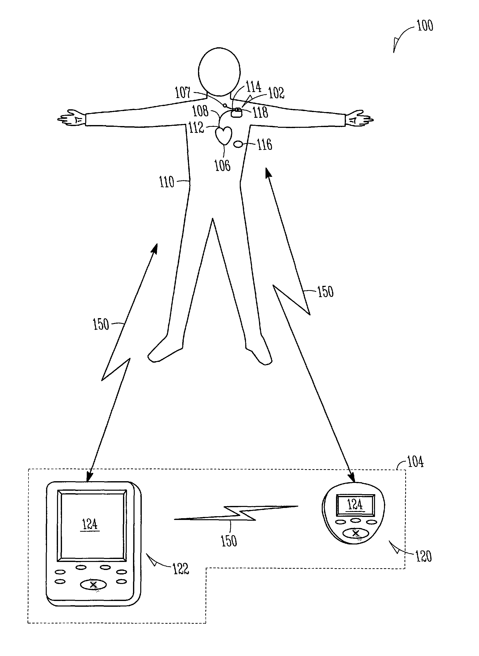 Monitoring of chronobiological rhythms for disease and drug management using one or more implantable device