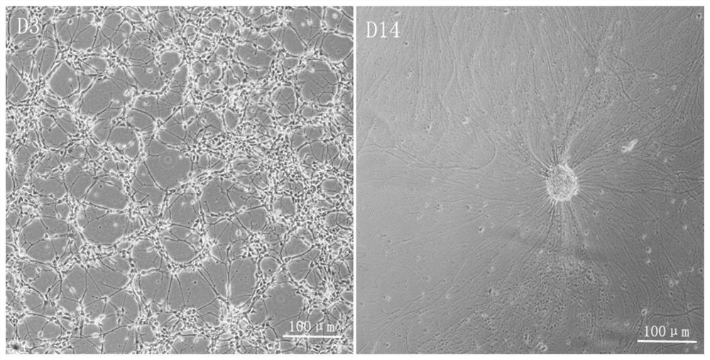 A method for inducing the differentiation of human spinal cord motor neuron precursor cells into spinal cord motor neurons