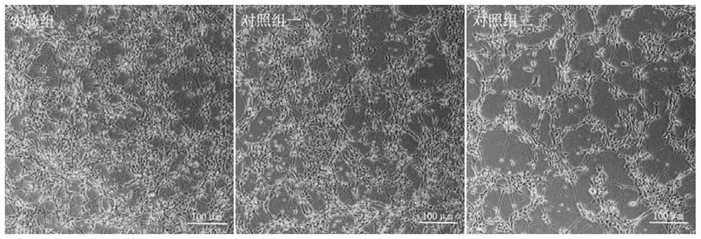 A method for inducing the differentiation of human spinal cord motor neuron precursor cells into spinal cord motor neurons