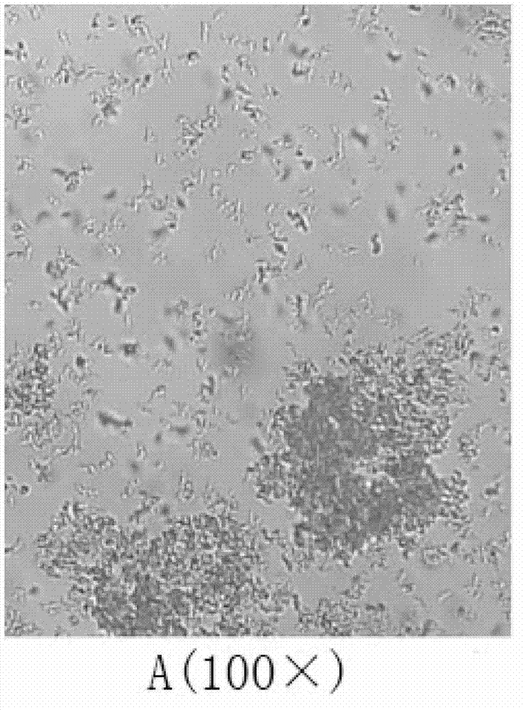 Expression preparation method and application of novel anticoagulant Aedes albopictus salivary gland aegyptin-like protein ALP