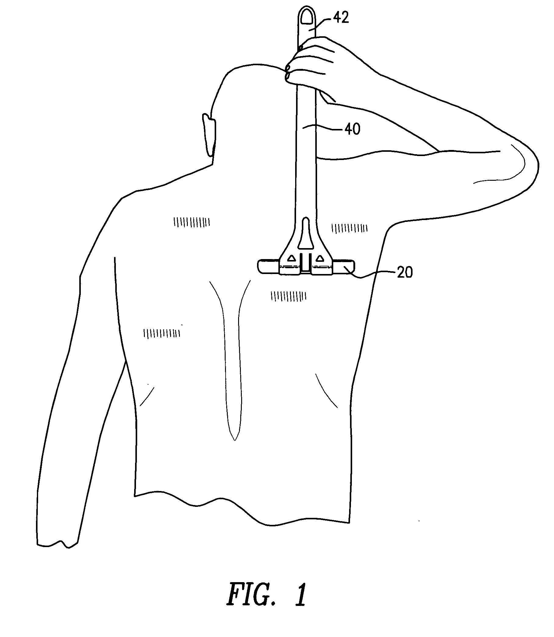 Back hair removal using comb and integrated blade