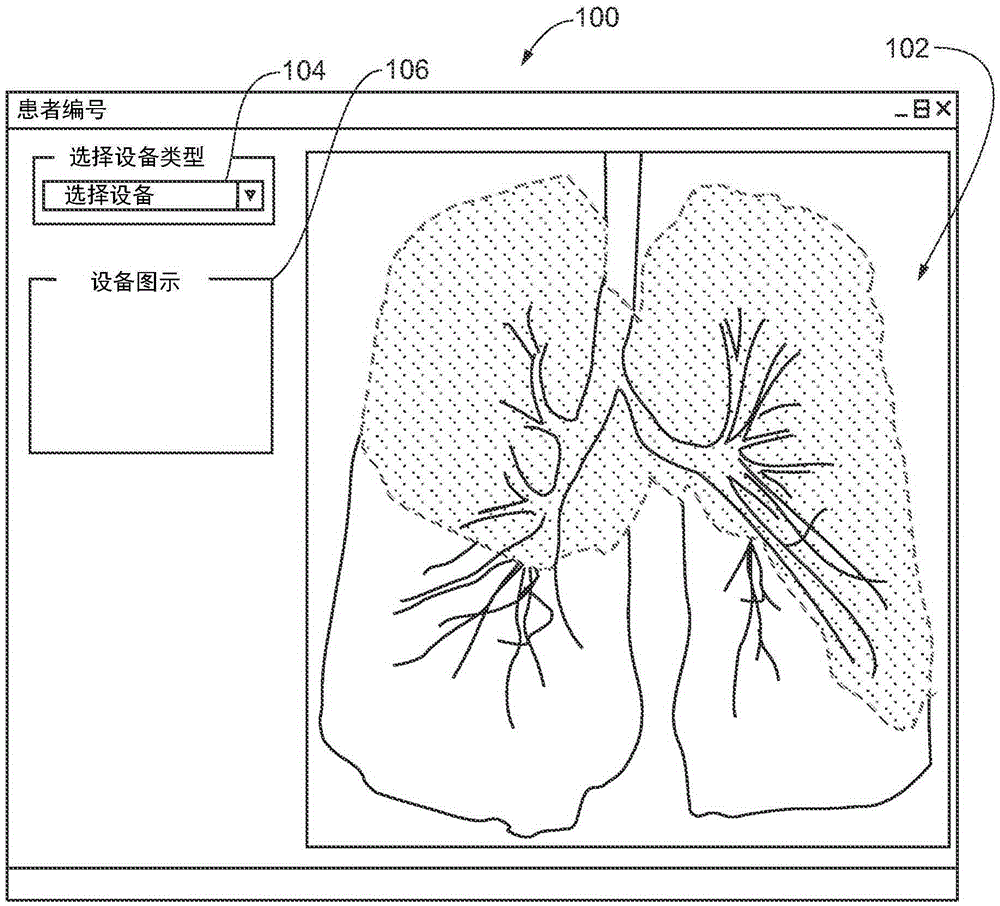 Treatment planning for lung volume reduction procedures