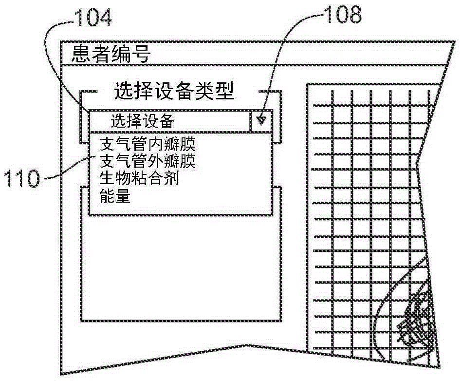 Treatment planning for lung volume reduction procedures